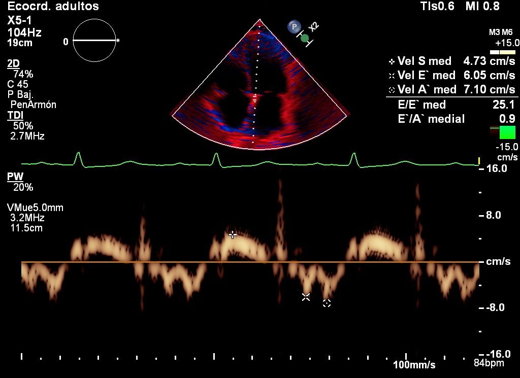 Heriberto Pruneda Ayala-10