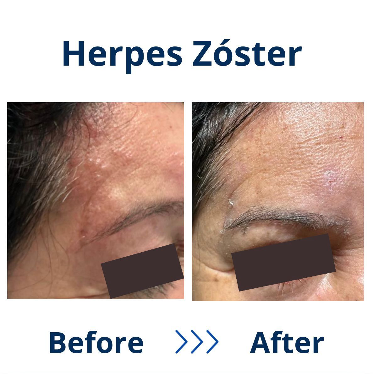 Itzel Anayn Flores Reyes-45