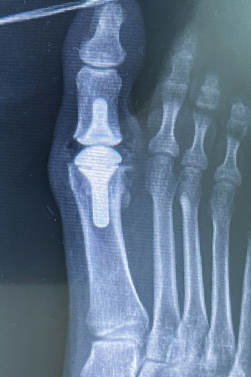 Cesar Daniel Maldonado Cortez-17