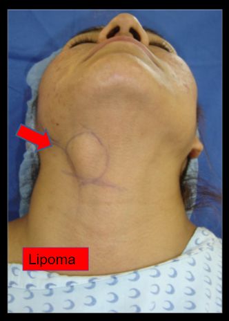 Diana Araceli Dávila Hernández-32