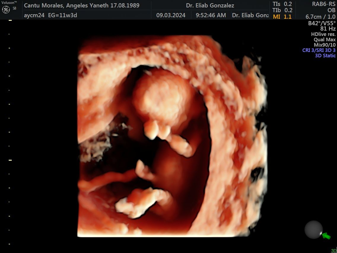 Eugenio Eliab González Guzmán-12