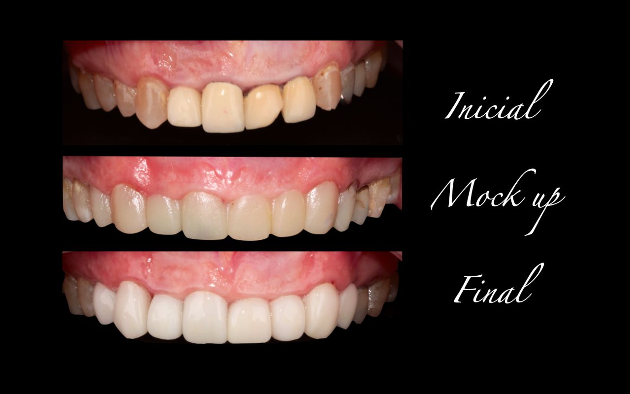 Aide Montserrat Orozco Gutierrez-54