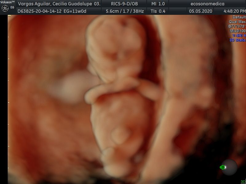 Héctor Bernardo Acevedo Manrique-22