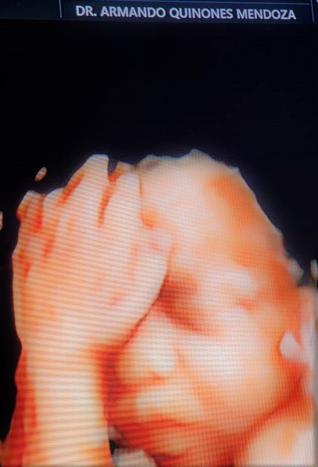 Armando Quiñones Mendoza-20