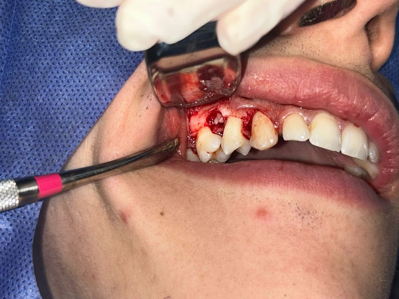 Elda Villarreal Garcia-2