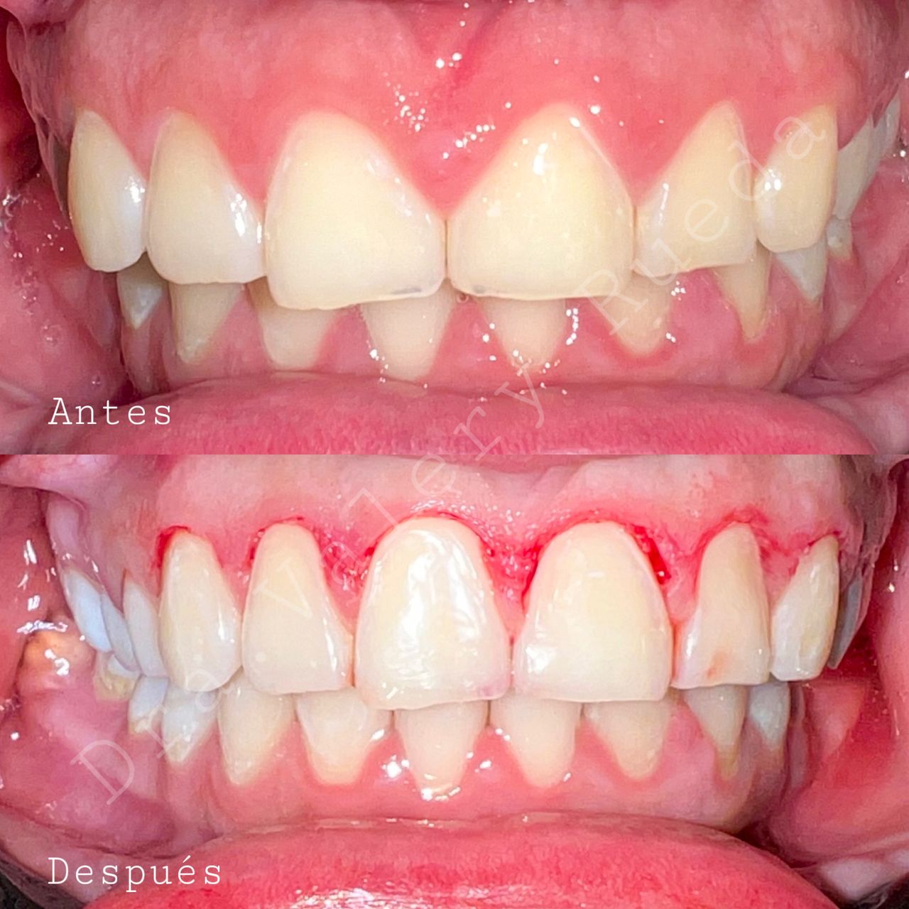 Valery Rueda Mendoza-4