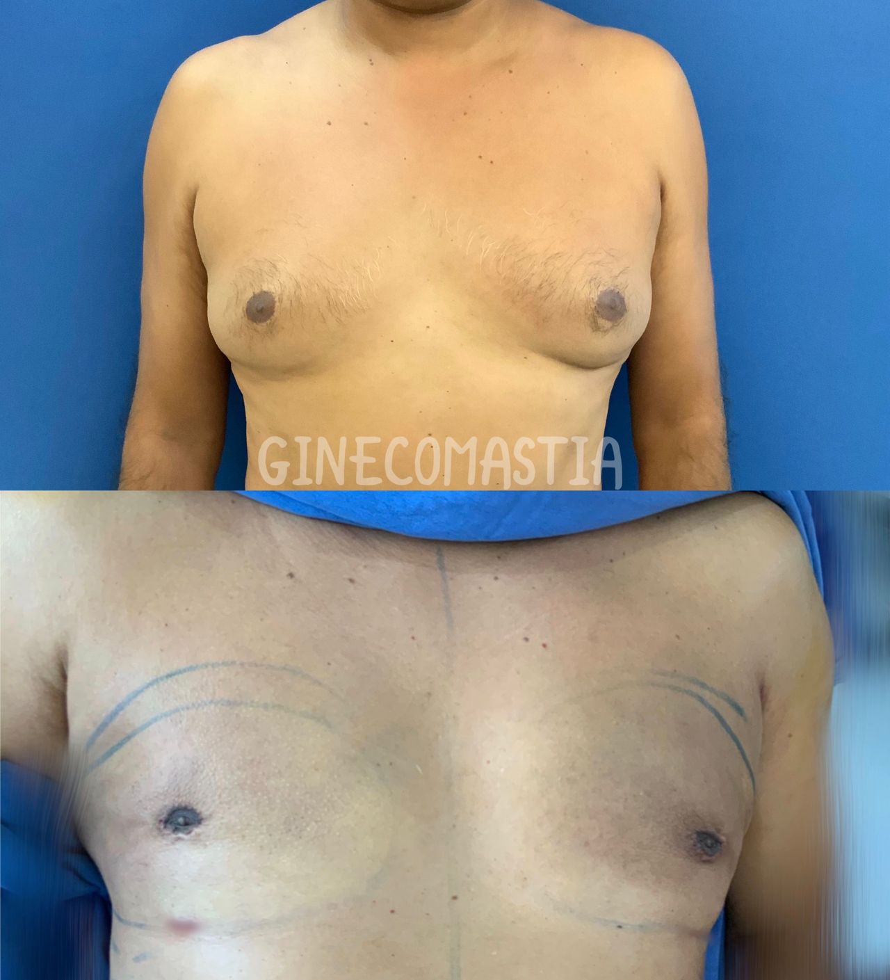 Giuseppe Tanzillo-77