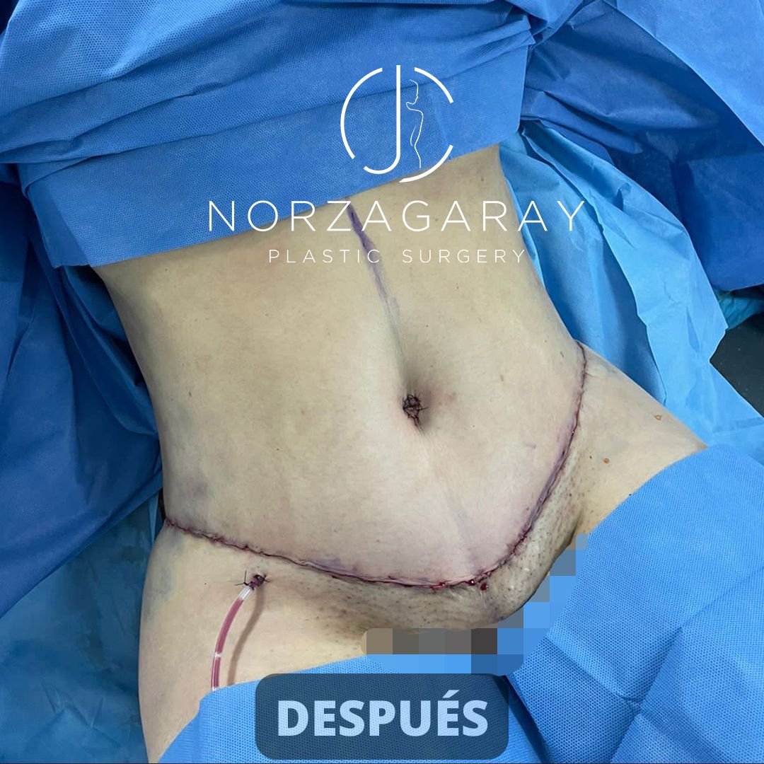 Juan Carlos Norzagaray-8