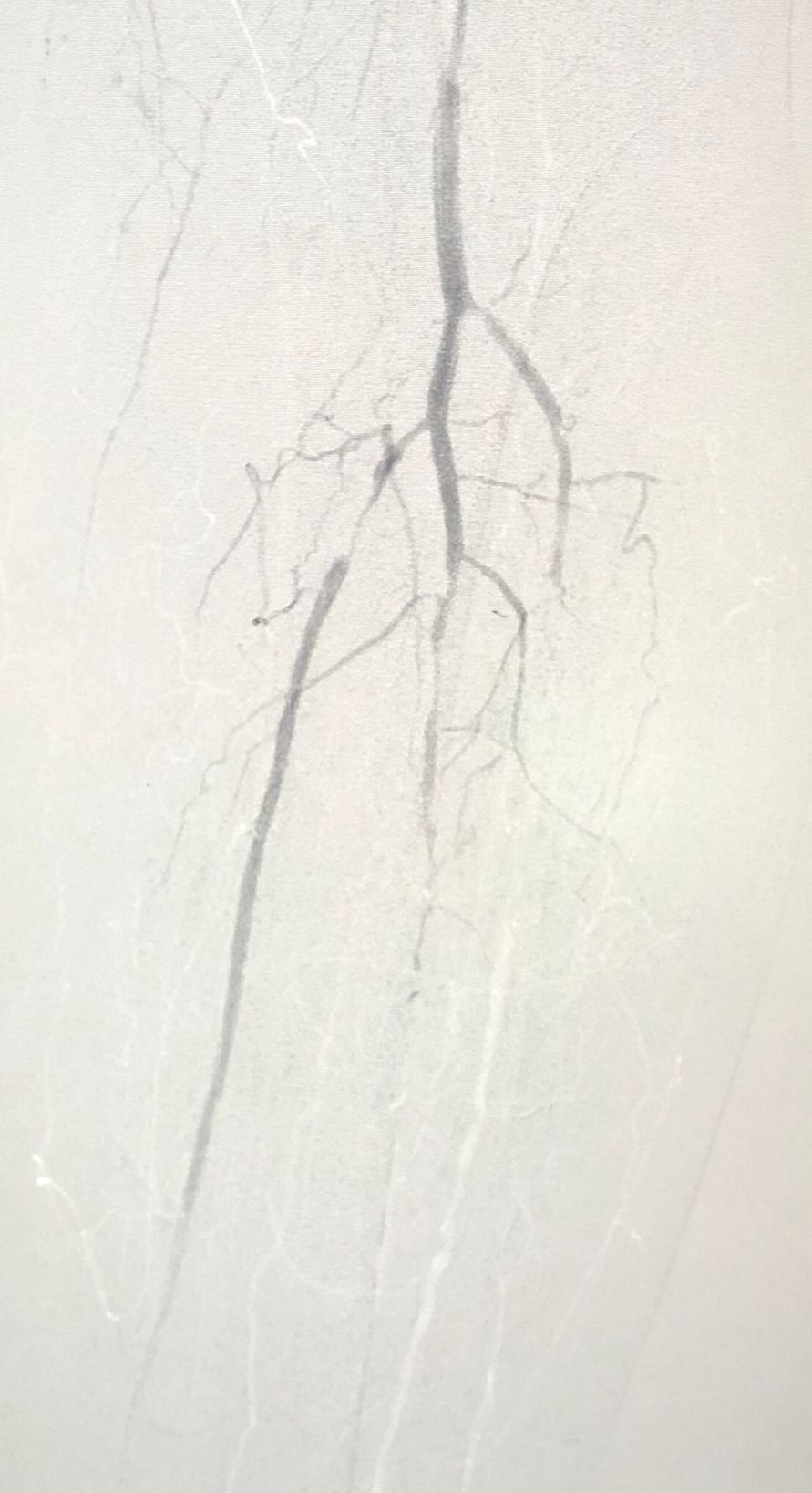 Miguel Abraham Lara Perez-6