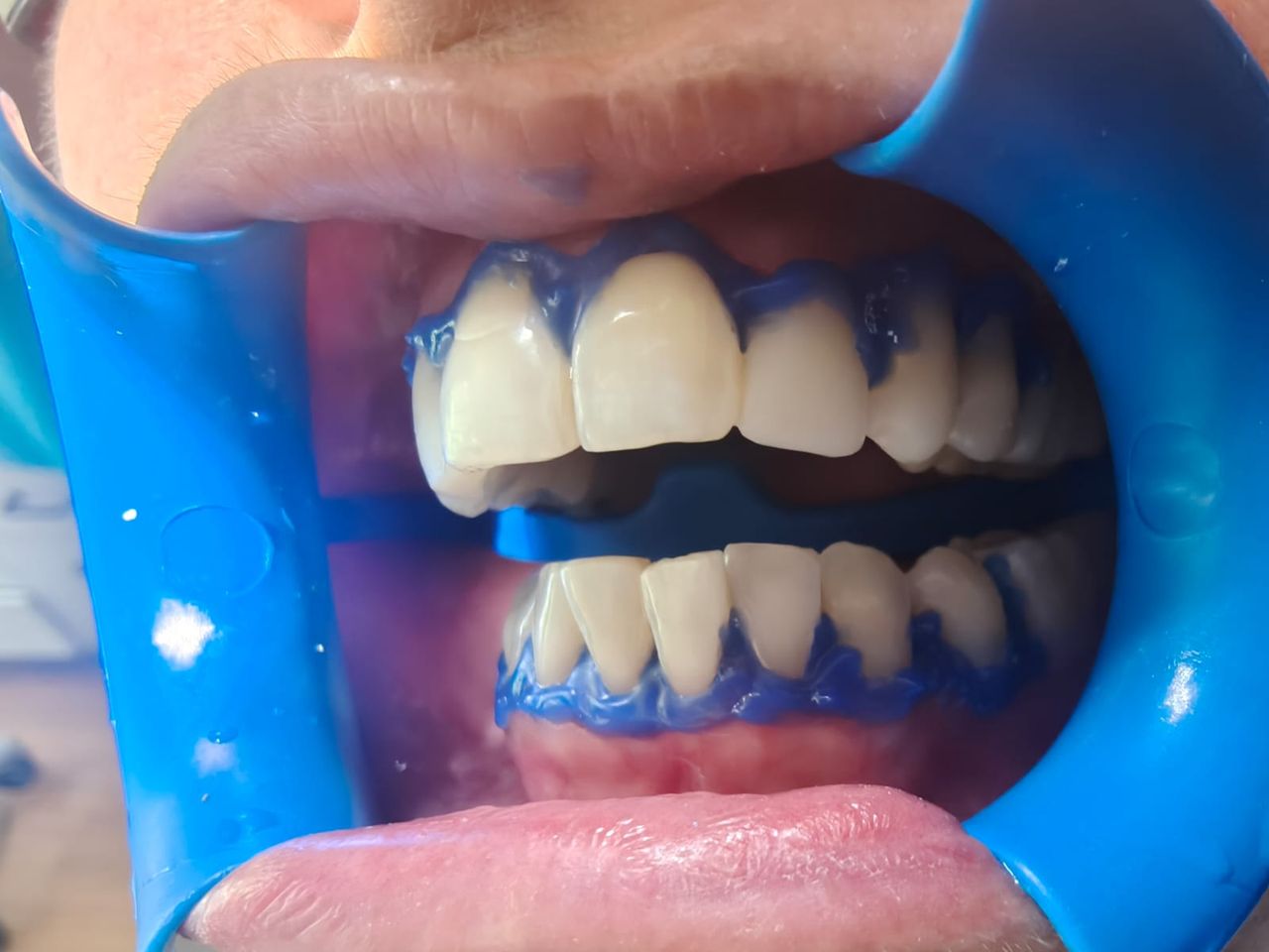 Pedro Badial Aceves-11