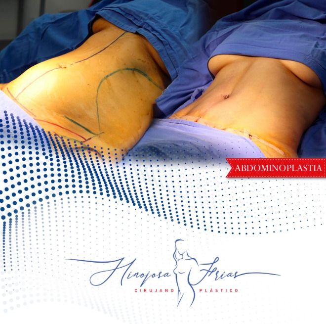 Miguel Ángel Hinojosa Frías-6