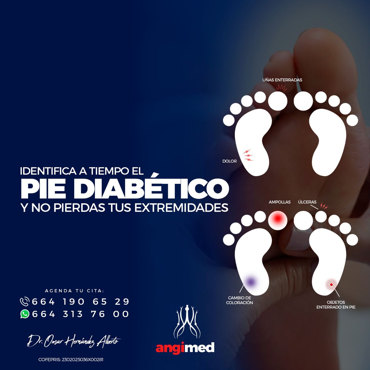 Omar Hernández Alberto-3