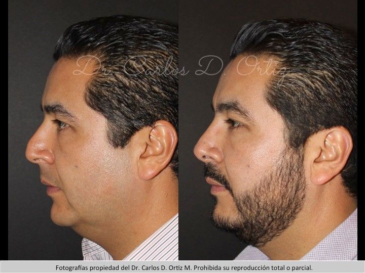 Carlos David Ortiz Moreno-56