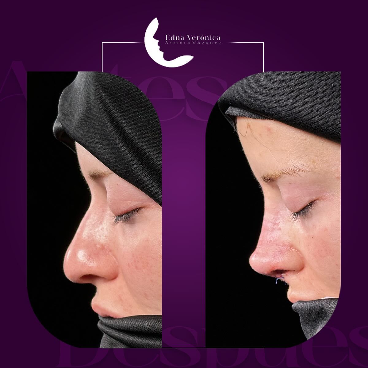 Edna Verónica Arrieta Vázquez-10