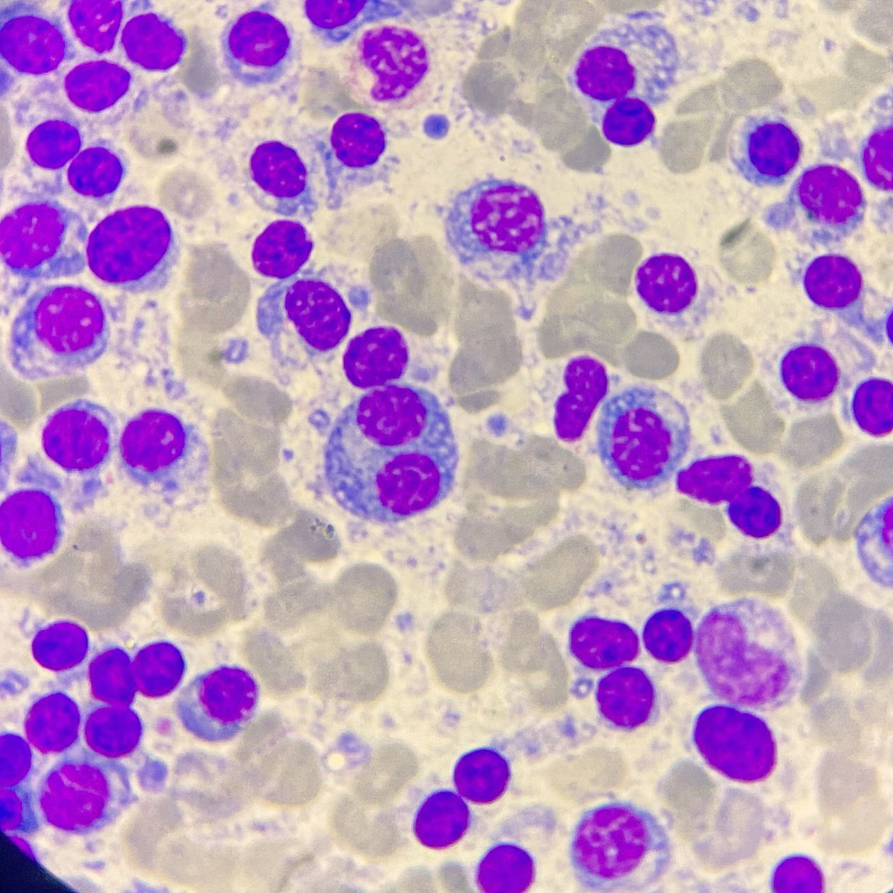 Juan Rangel Patiño-7