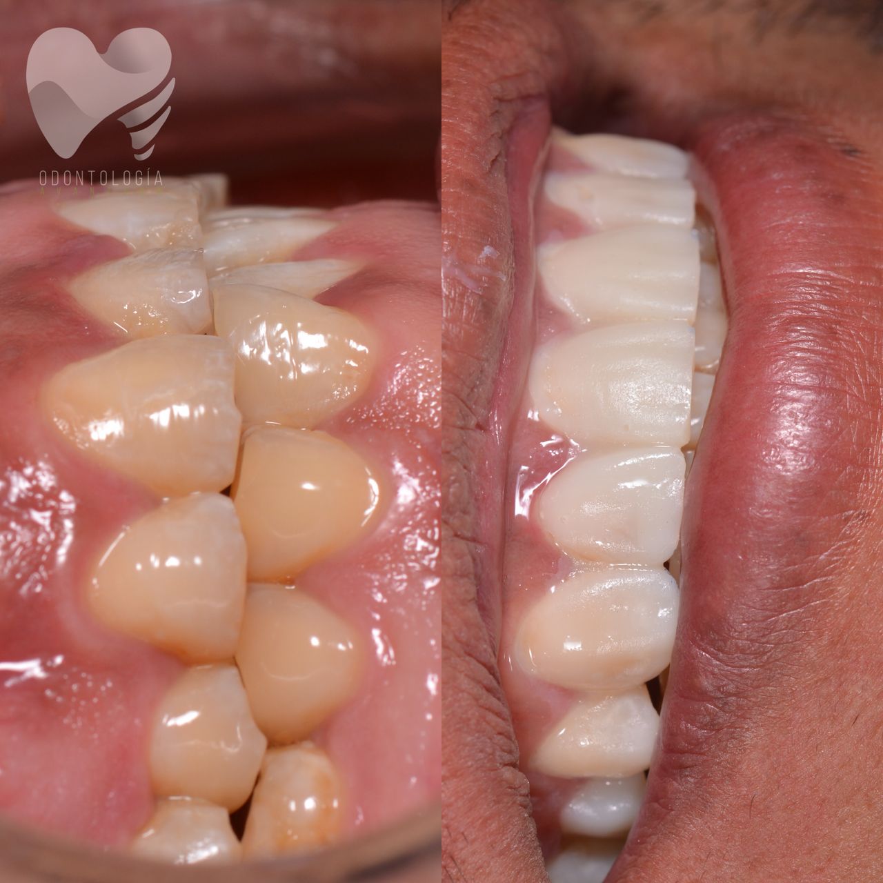 Katherine Betzabet Regil Rojas-11