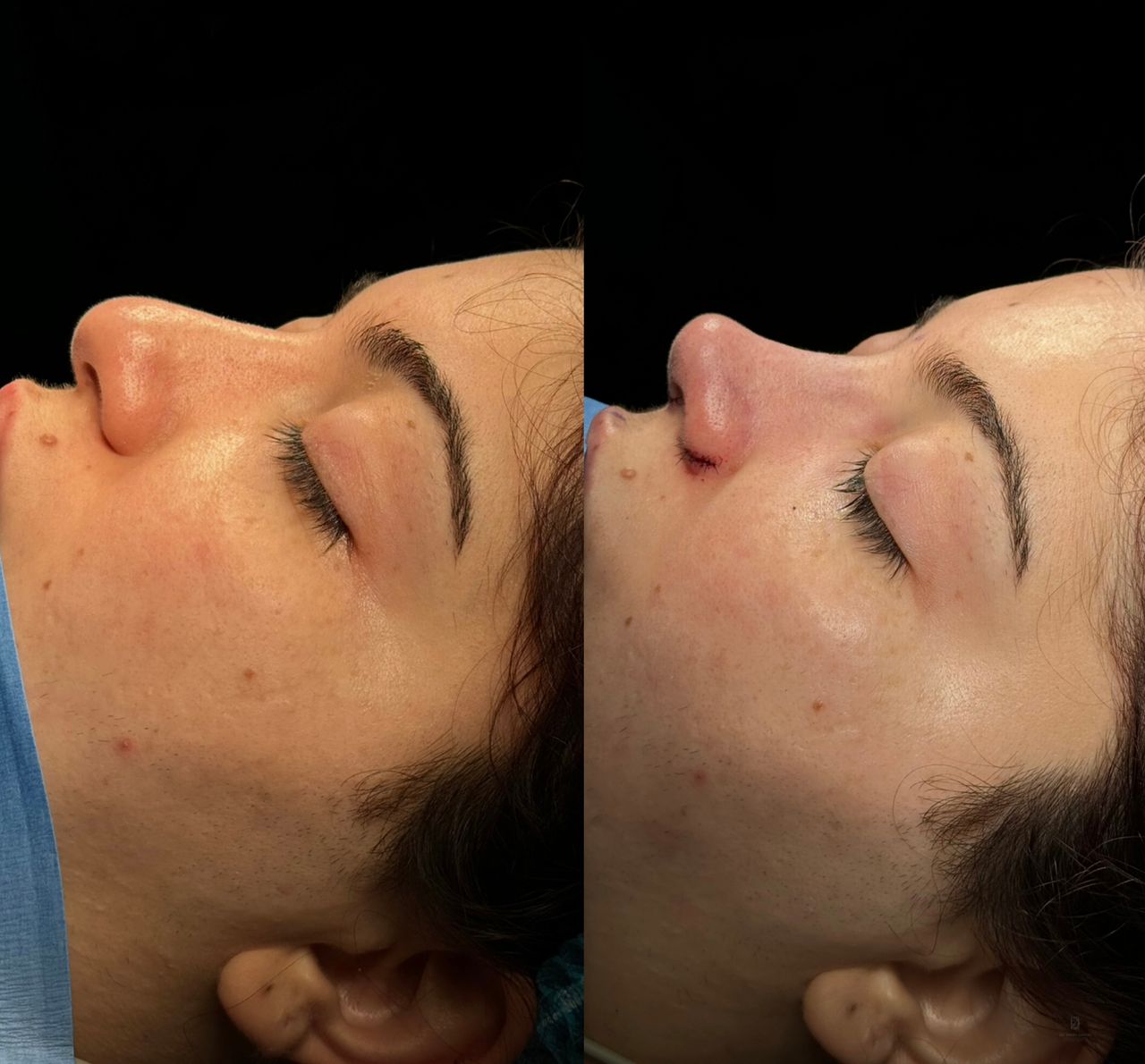 Angel Castro Urquizo-206