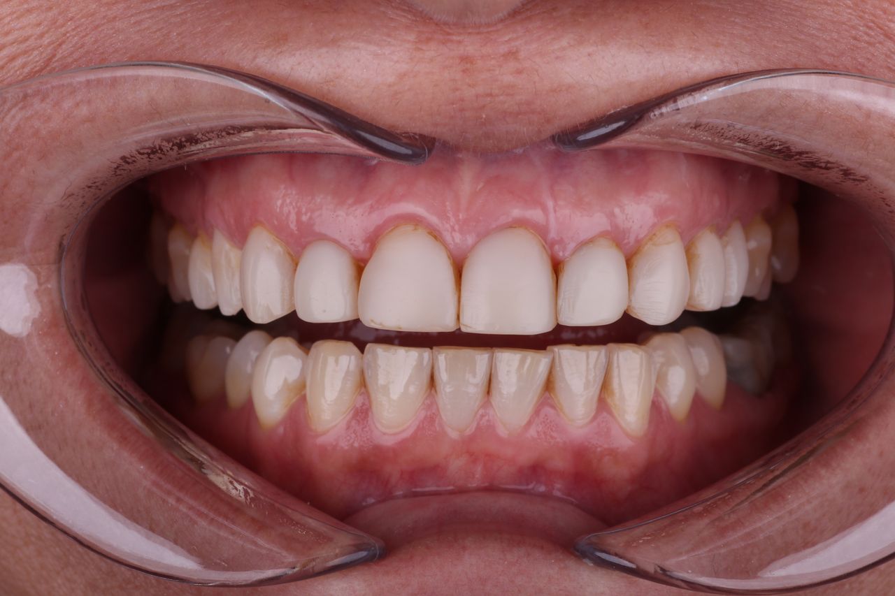 Daniel Perez Parcero-5