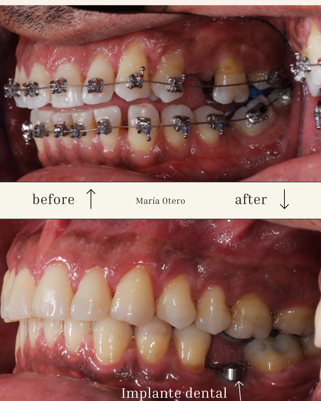 Maria Jesus Otero Lois-3