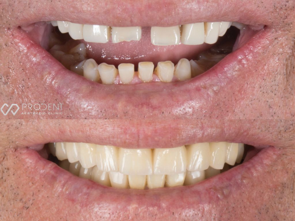 Ulises Pérez Murillo-33