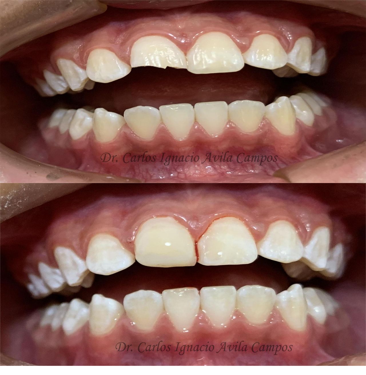 Carlos Ignacio Avila Campos-13