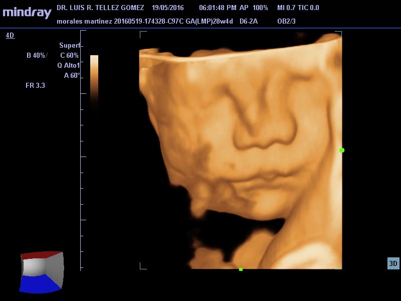 Luis Reynerio Téllez Gómez-3