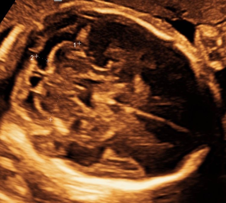 Ricardo Morales Velázquez-3