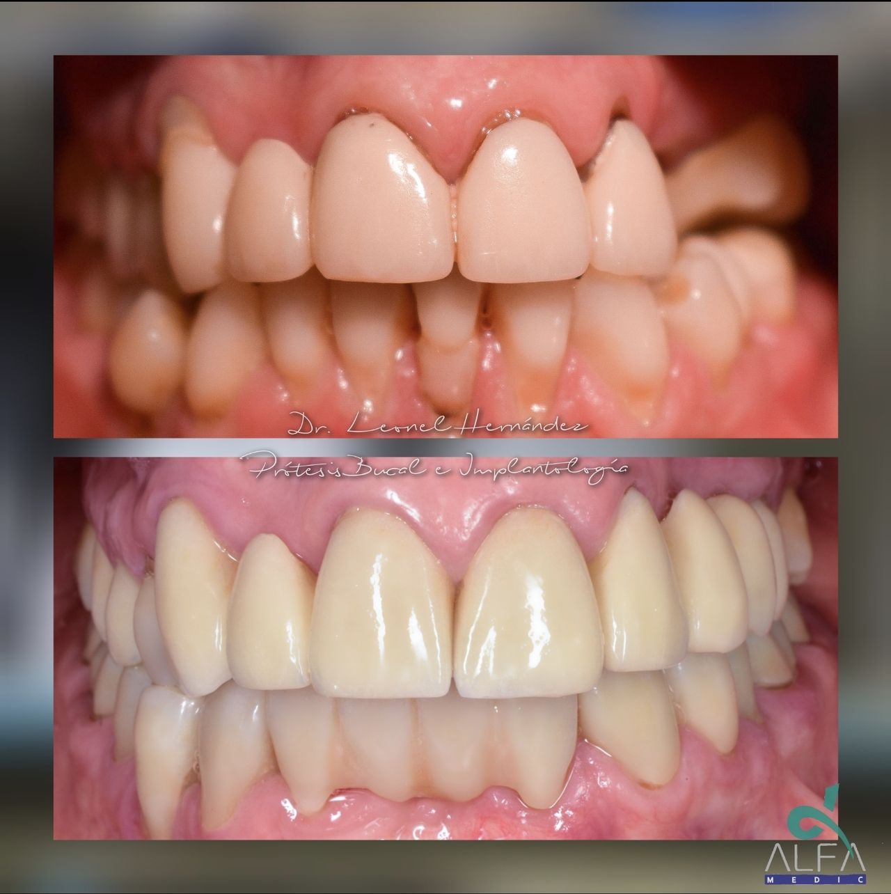 Leonel Hernández Gómez-4