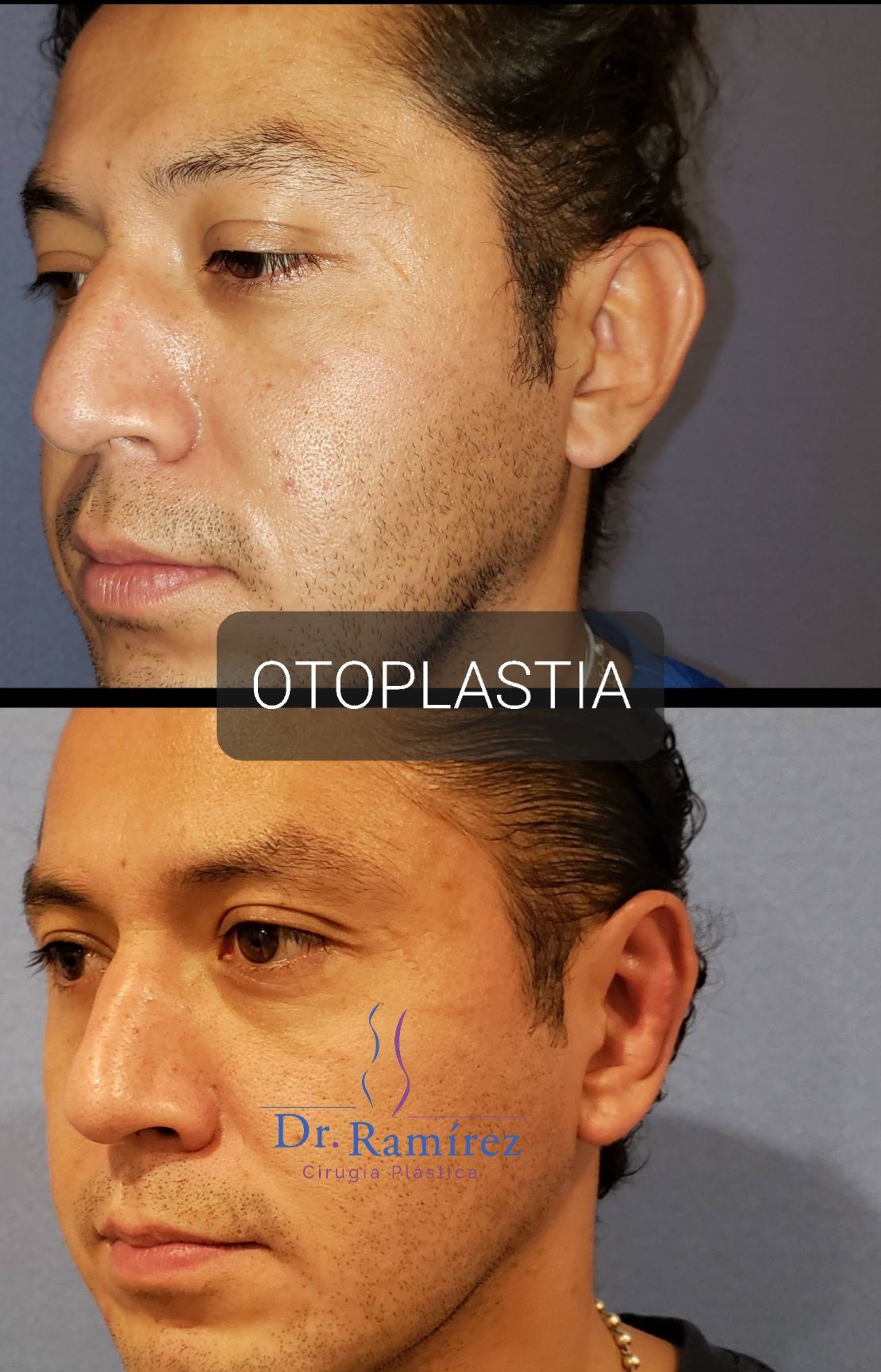 Edgar Ramírez López-28