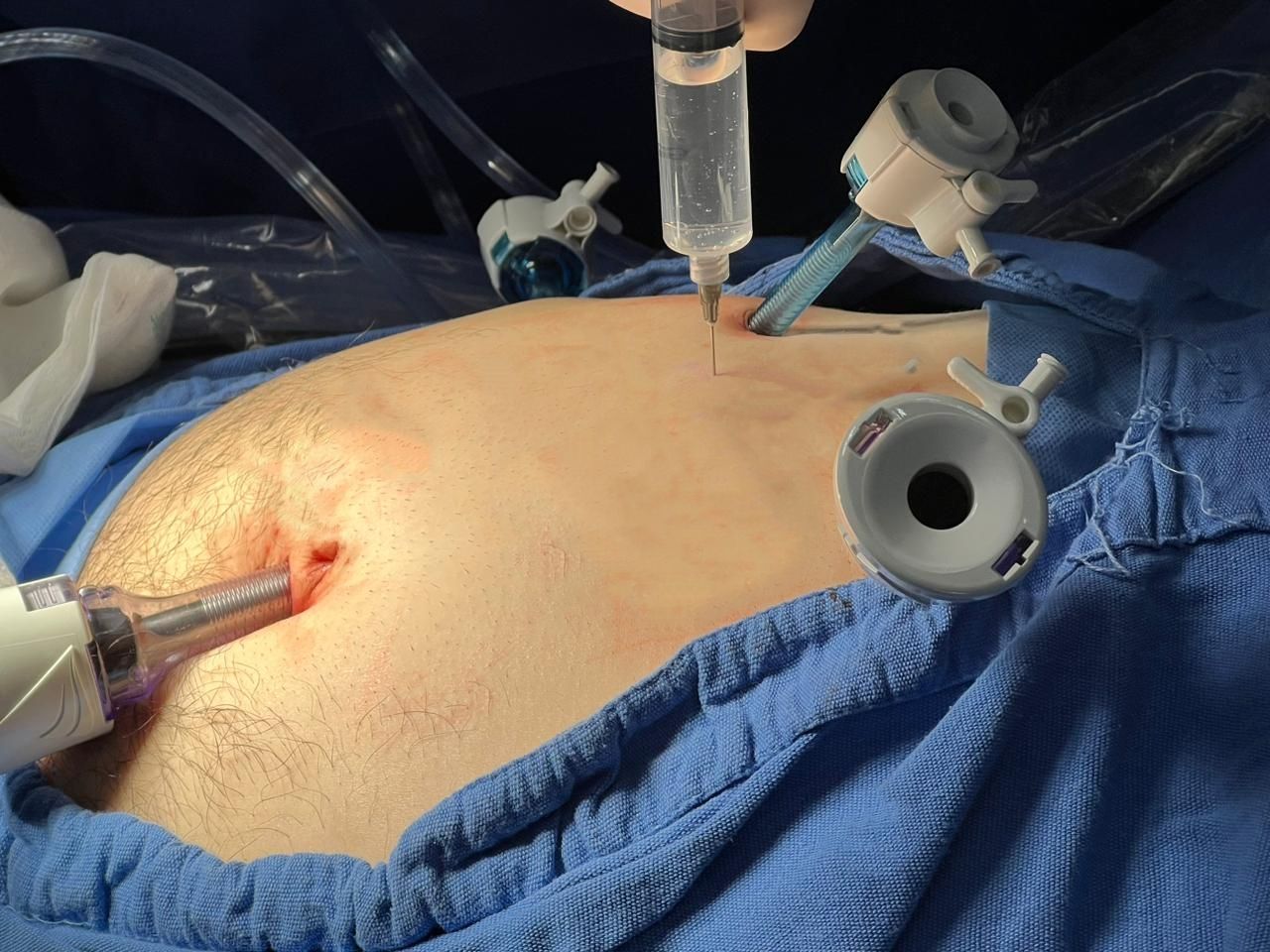 Bernardo Álvarez Hernández-2