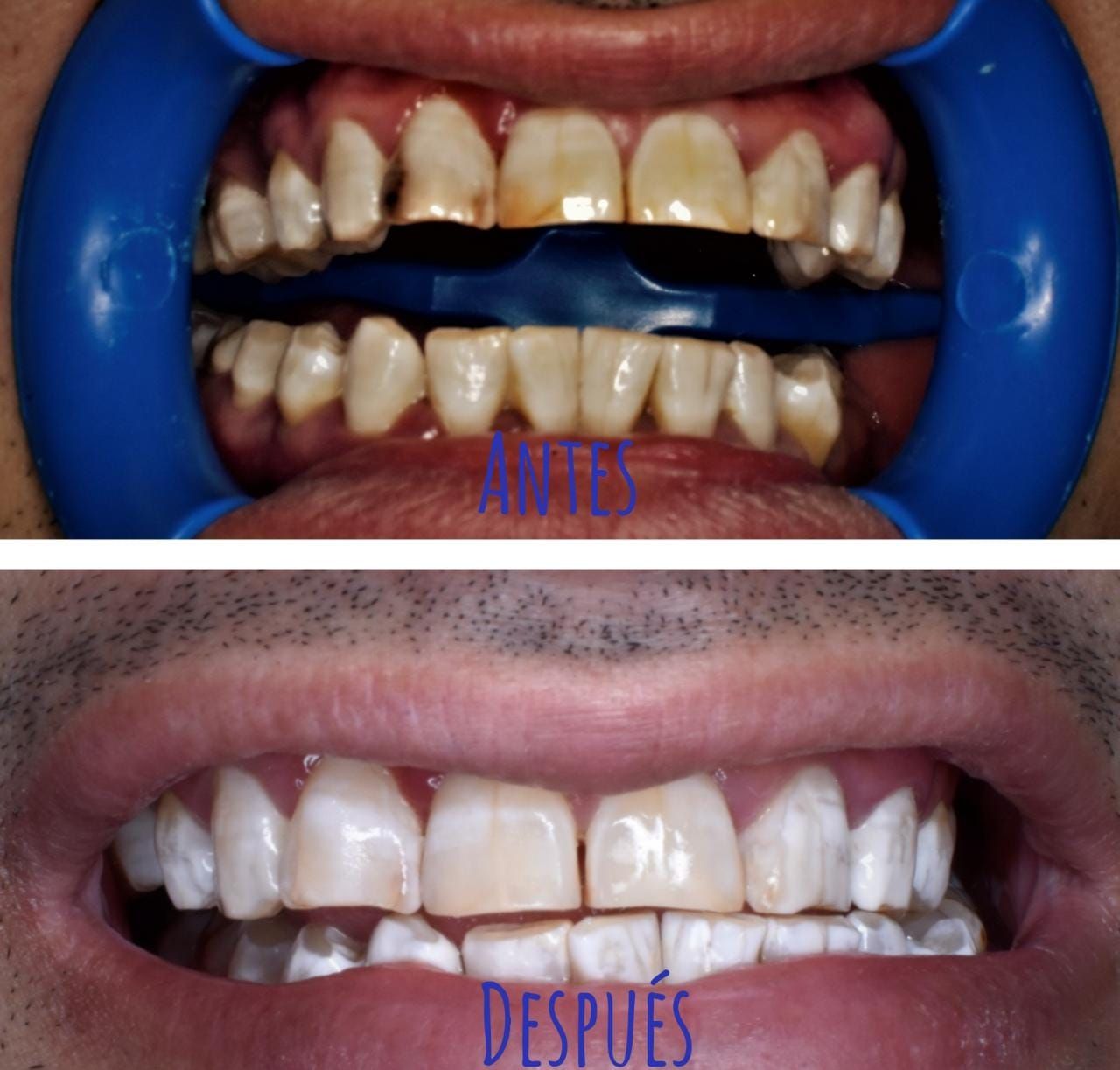 Ricardo Ivan Martínez García-4