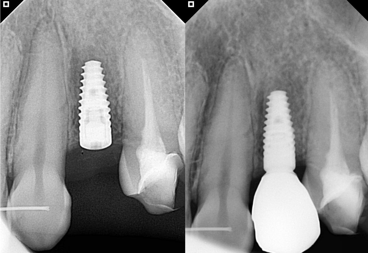 Luis Alonso Flores Reyna-1