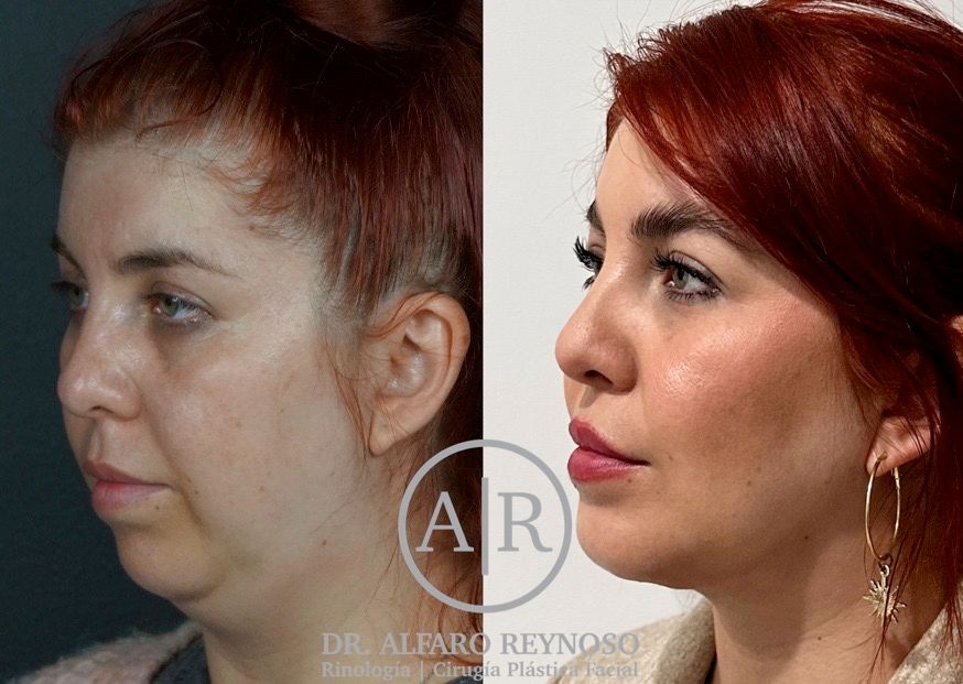 Jose Alberto Alfaro Reynoso-9