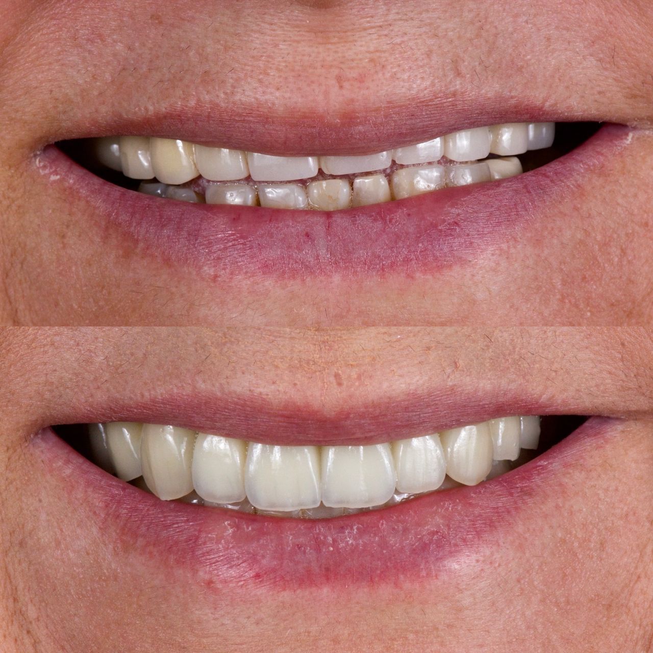 Mauricio Villegas Akena-14