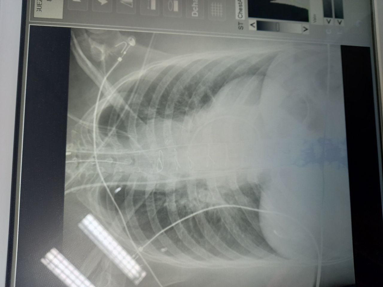 Emmanuel Adrian Lazcano Diaz-7