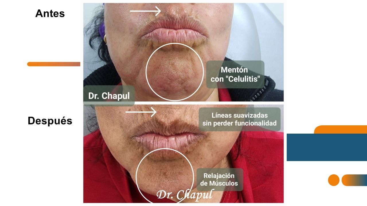 José Luis Muñoz Chapul-20