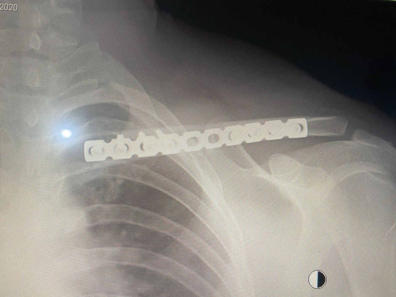 Alberto Lorenzo Cortés-12