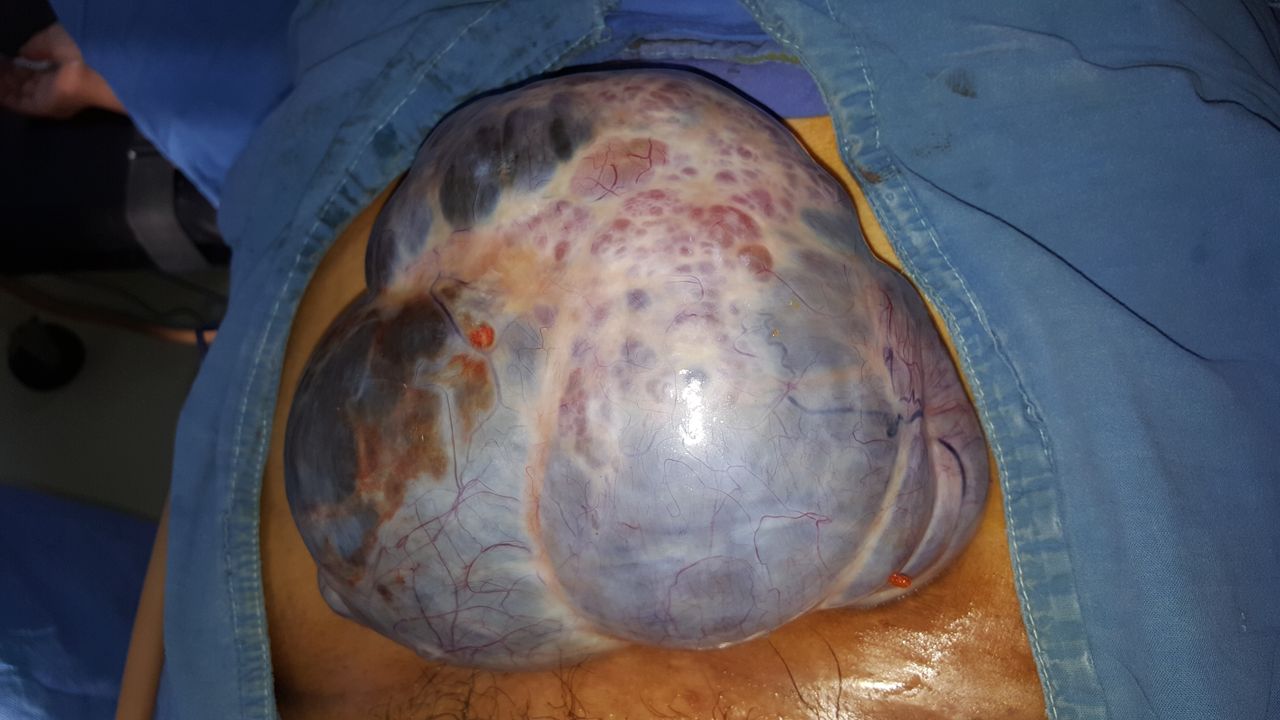 Ángel Millán Juárez-36