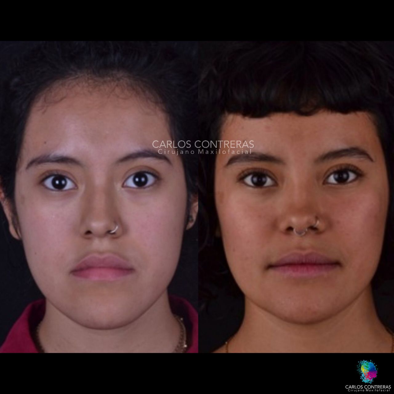 Carlos Ernesto Contreras Castellanos-6