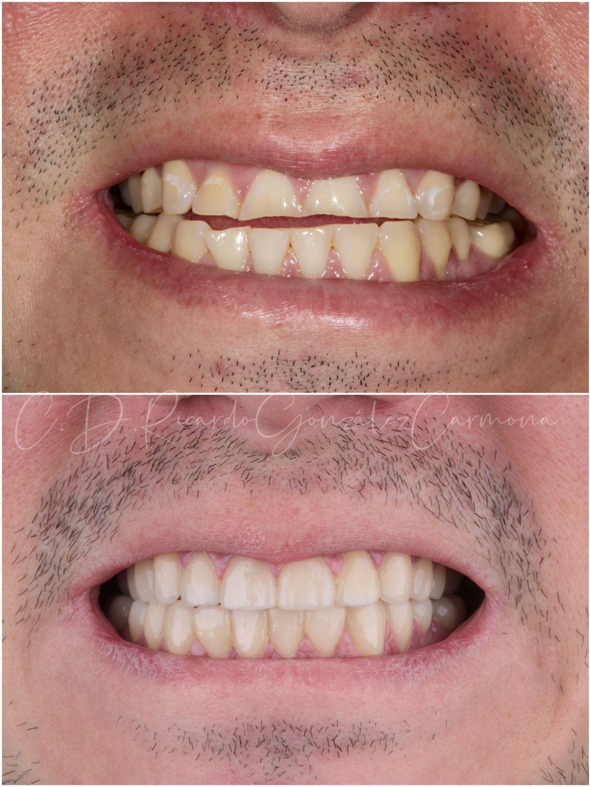 Ricardo González Carmona-14