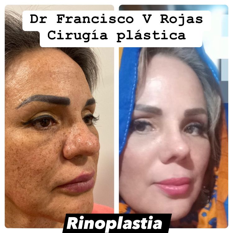 Francisco Rojas Aguilar-6