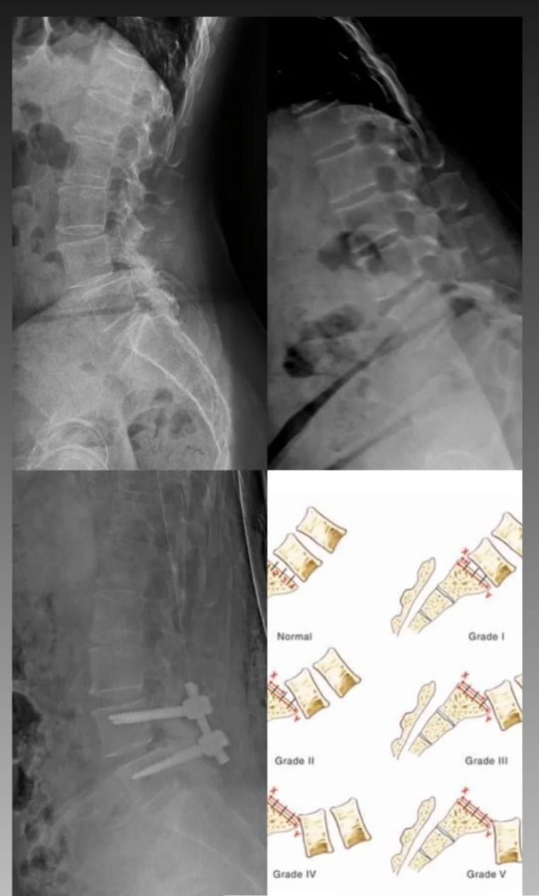 Fernando Reyes Tarrago-3