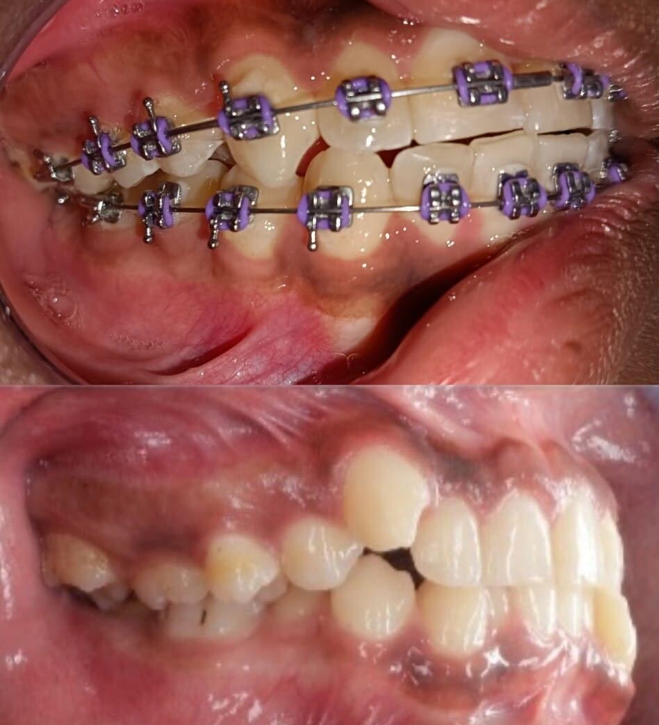 Luz Anel Valente Lozano-16