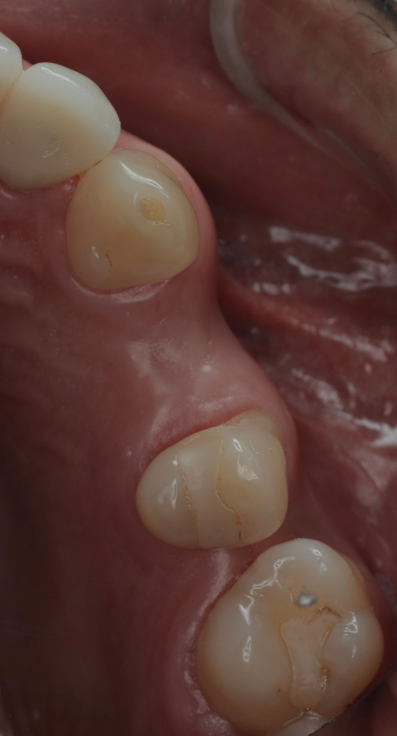 Marco Tulio Alzaga Vega-3