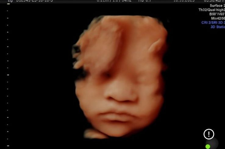 Graciela Elizabeth De La Torre Alvarez-31