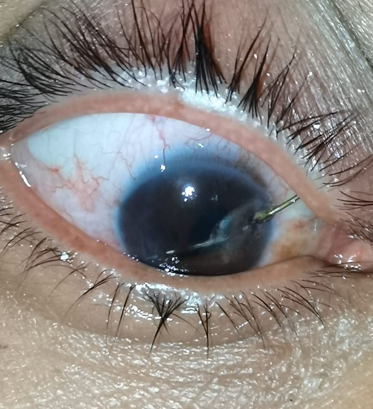 Kalid Barush Hernández Diaz-9