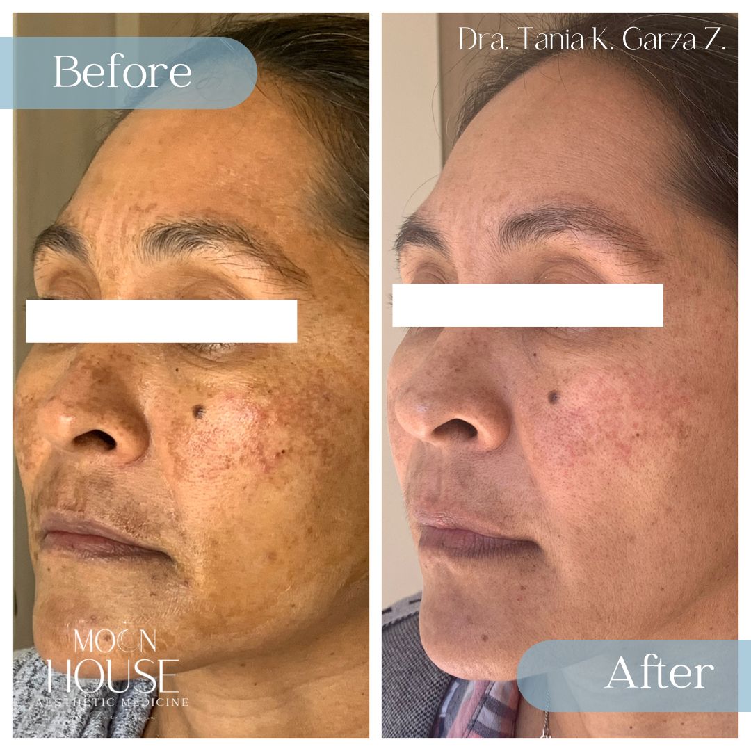 Tania Karine Garza Zepeda-6