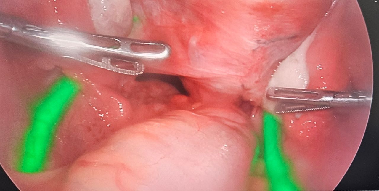 Ramón  Pascacio Pérez -4