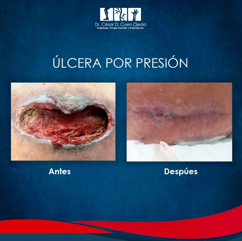 César Daniel Cuen Ojeda-21