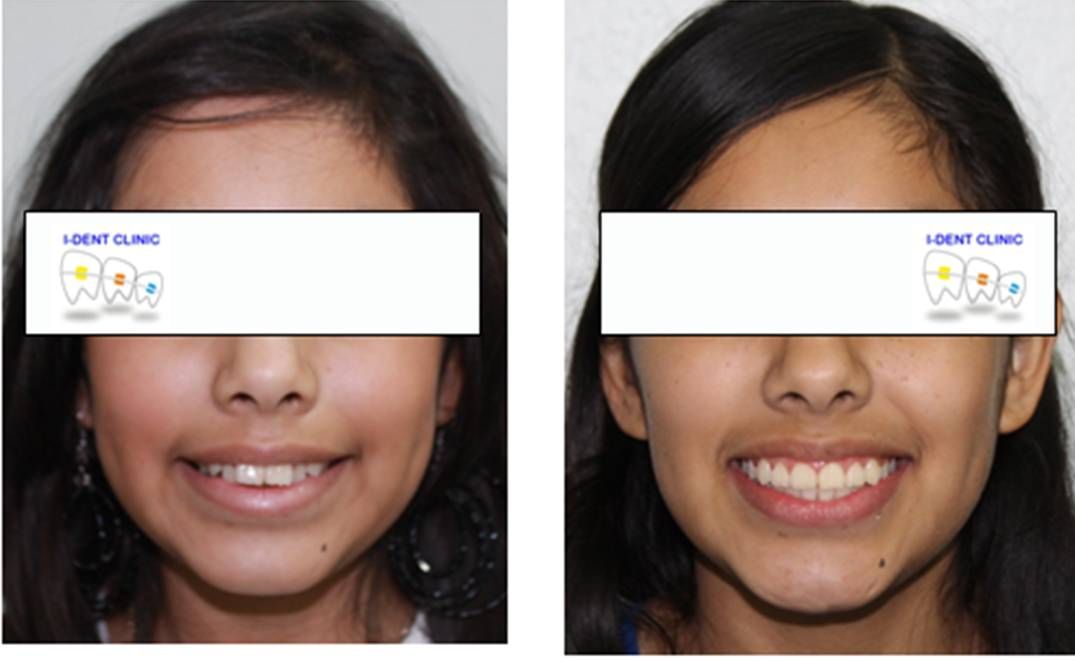 Iris Ocampo Fonseca-8